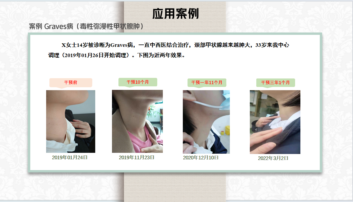 721a9ec2c0439b4146edcc7b59362b9.png